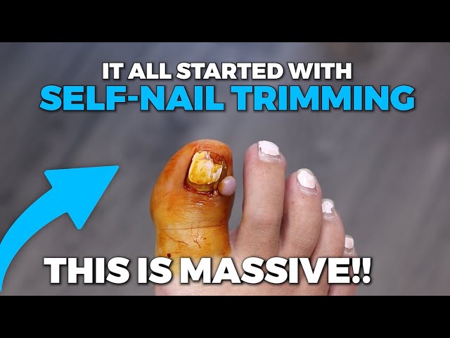 Look at this massive toe meat!!!!