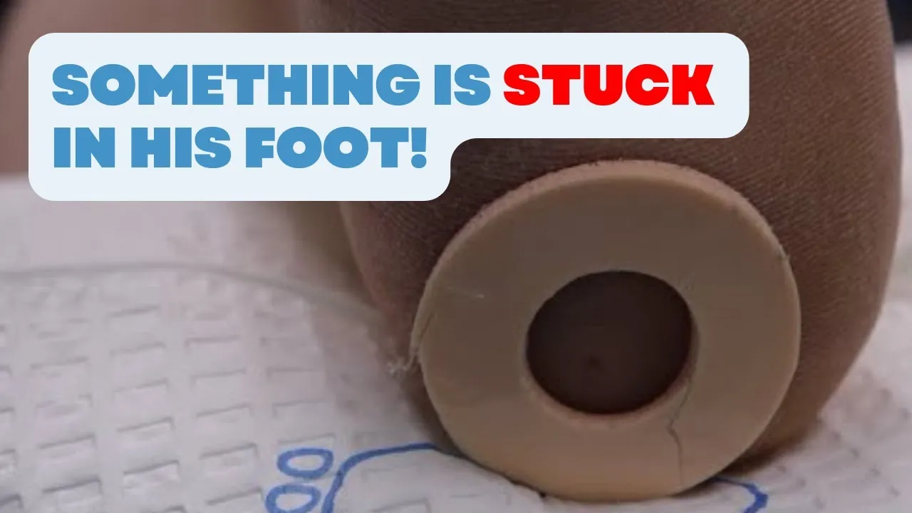 Have you had something stuck on your foot?!