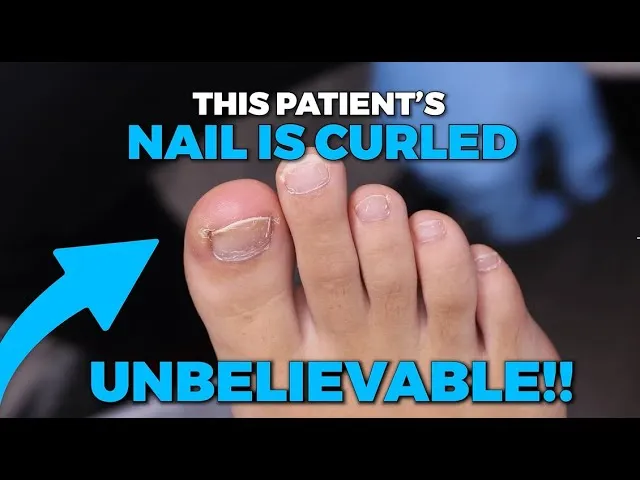 She doesn't remember how her nails ended up like this?!