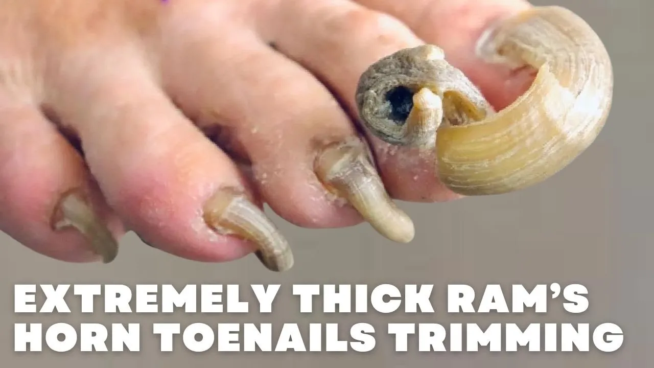 Trimming of extremely thick ram’s horn toenails ***not click bait***