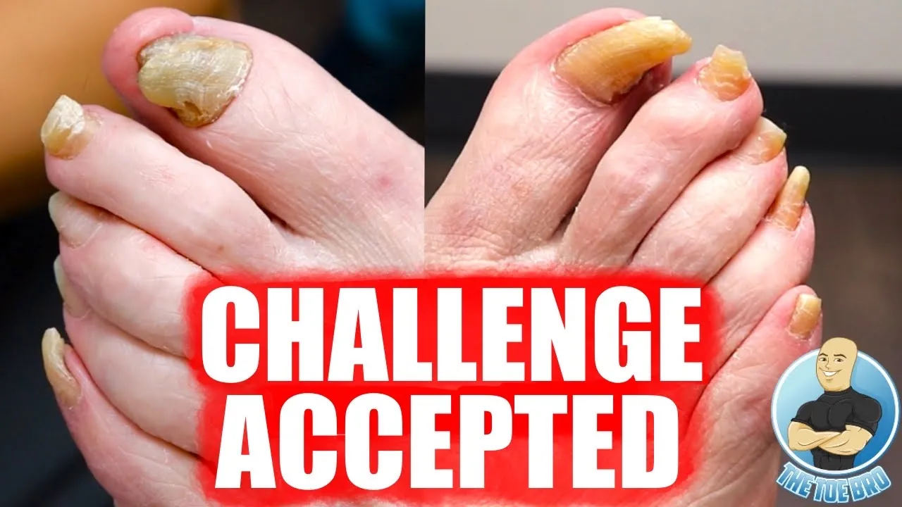 Toenails too thick and hard to cut???