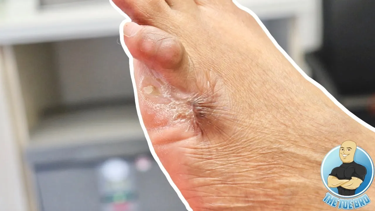 She lost her baby toe after getting a pedicure!!!