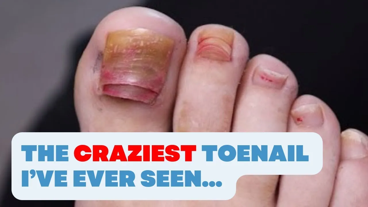 Why did she let this happen??!