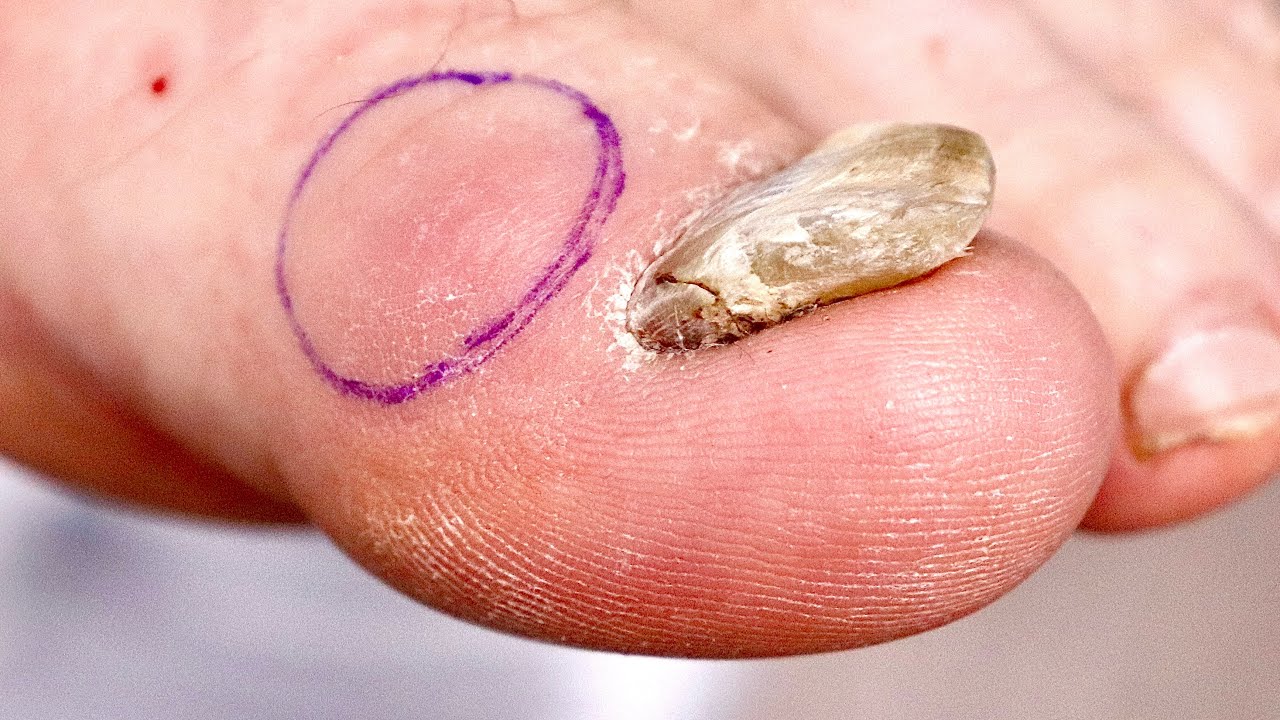 What's inside this toe bump?!?!