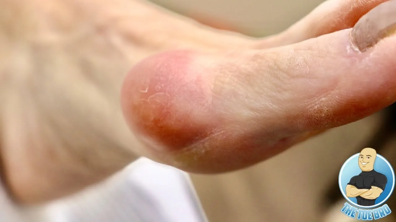 There is something growing in her big toe joint!!! ***huge growth removal!!!***