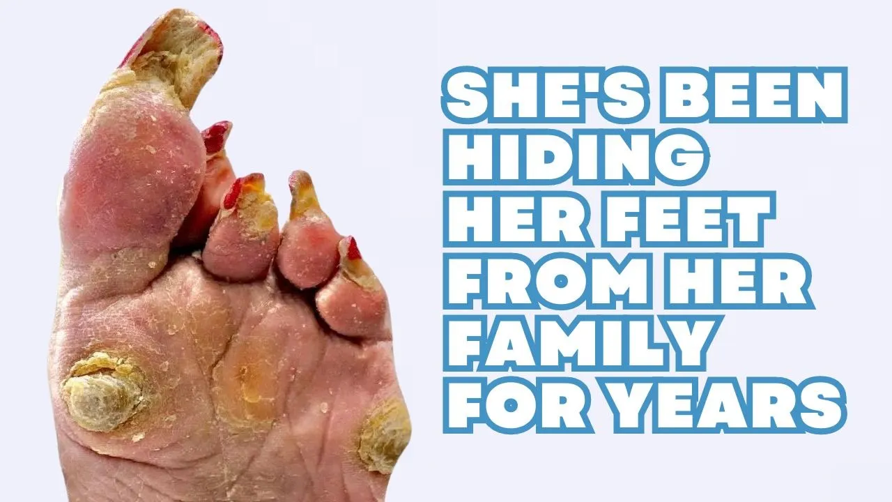 She's been hiding her feet from her family for years ***part 1: super thick & long toenails***