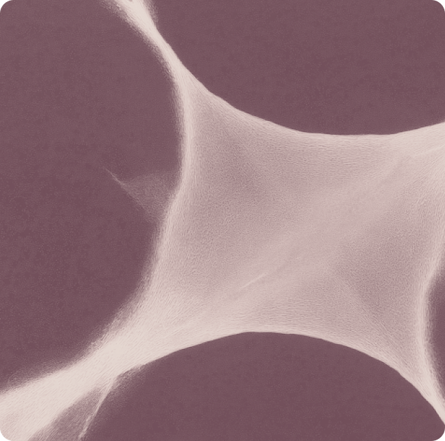 A prognostic neural epigenetic signature in high-grade glioma