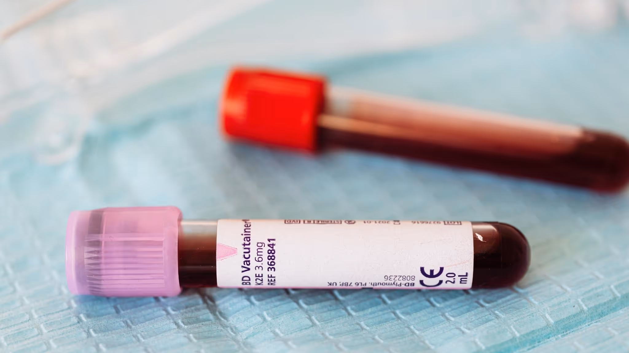 Two vials of blood, recently drawn, are awaiting preparation to be used in Platelet-Rich Plasma (PRP) and ozone injection therapy in Utah Valley.