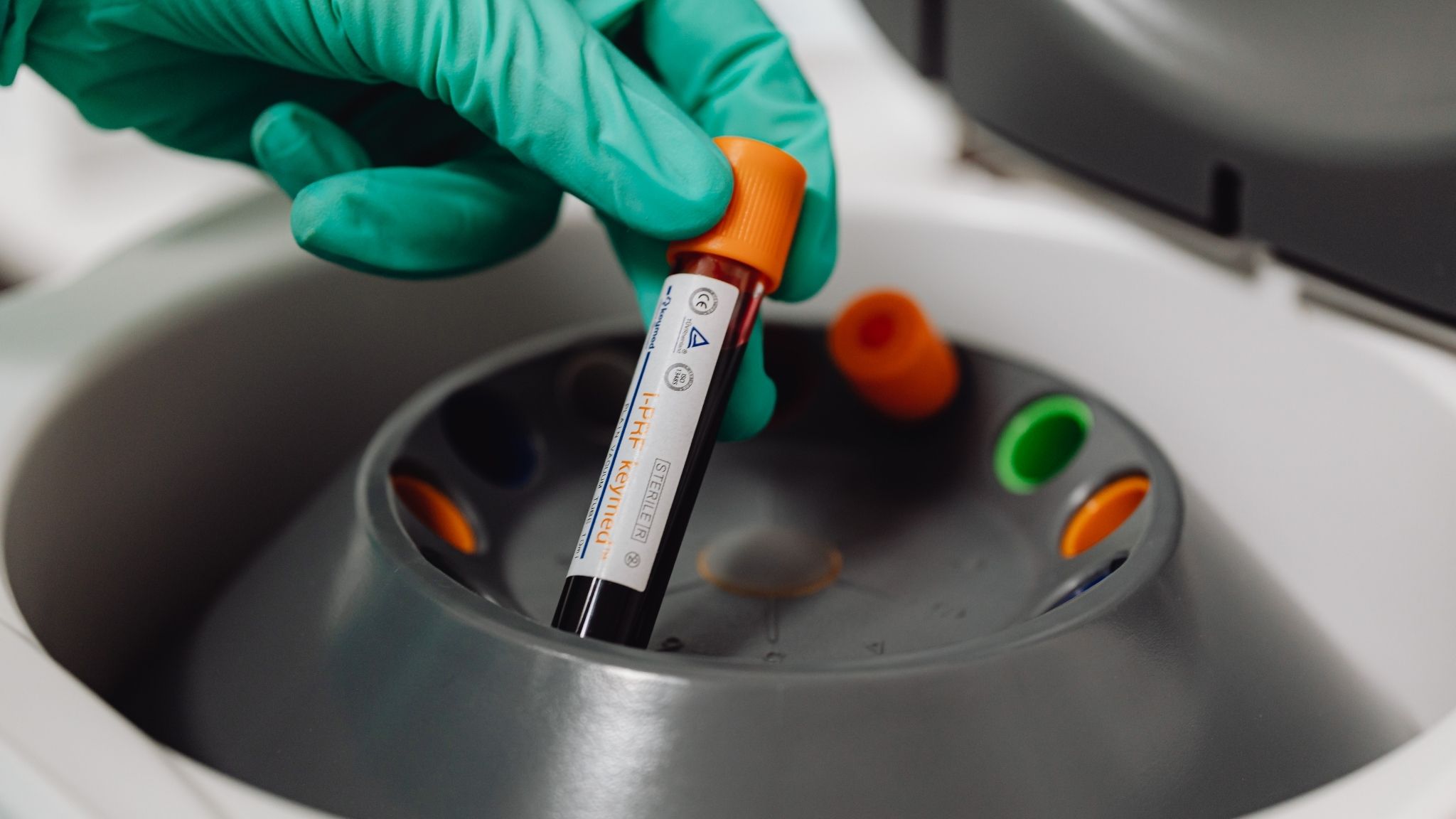 A gloved hand places a vial of blood into a centrifuge in preparation for Platelet-Rich Plasma (PRP) and ozone injection for athletic recovery in Utah Valley with Dr. Bridger Cutler.