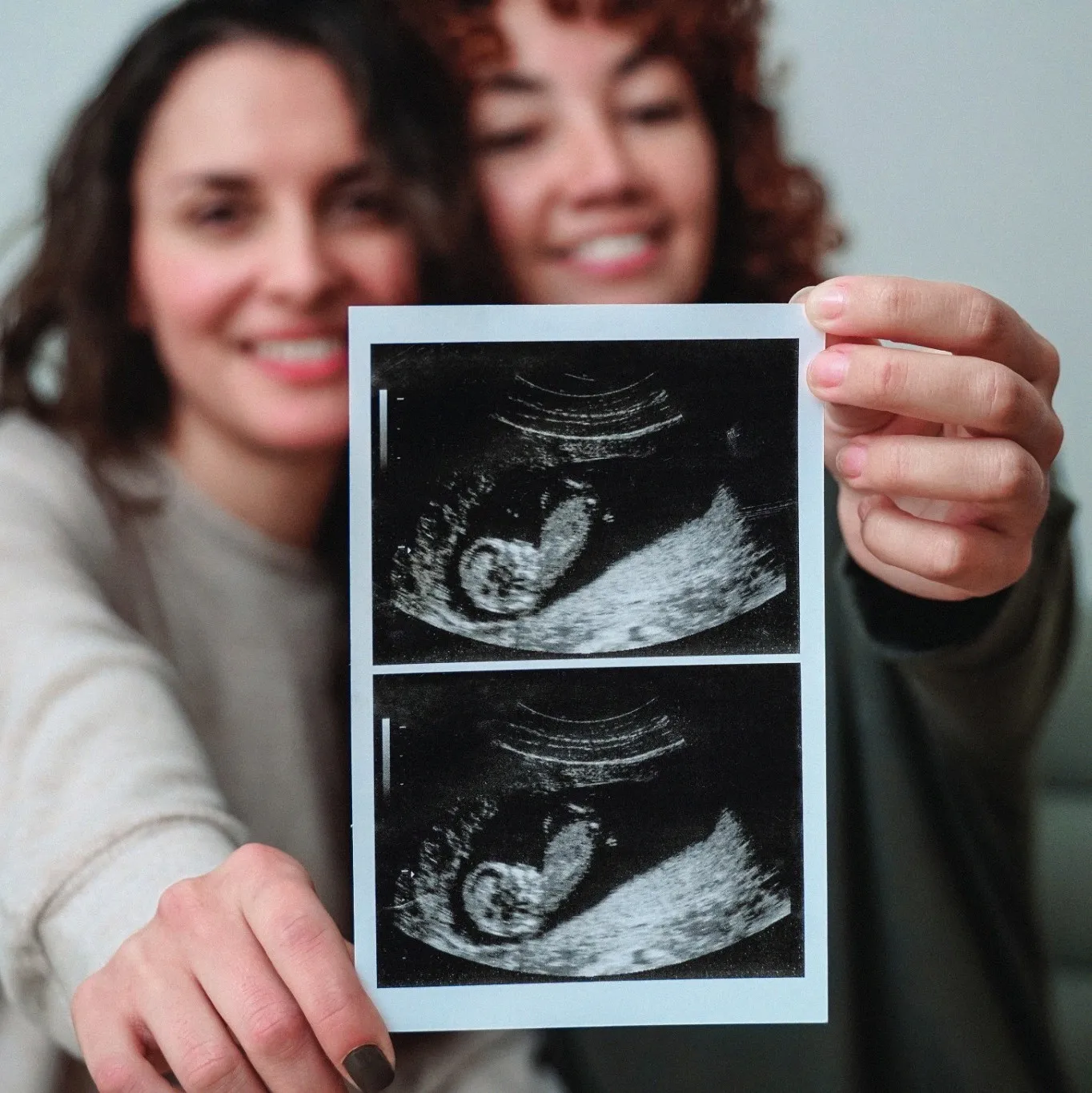 Two women with ultrasound