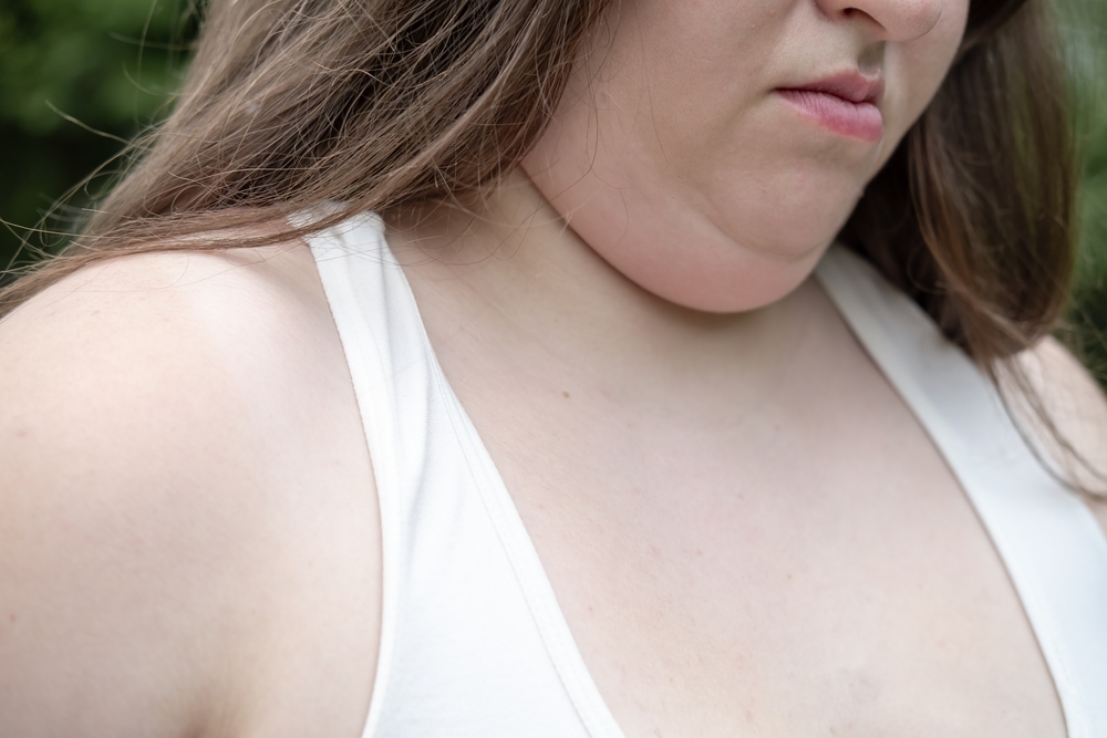 How long does it take to see CoolSculpting results