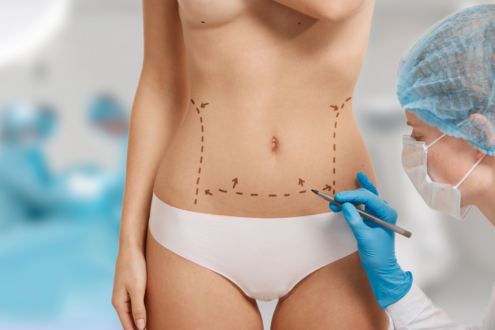 CoolSculpting Aftercare 