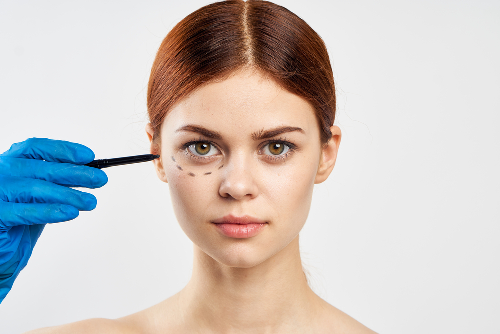 Bunny Lines Botox in Jacksonville