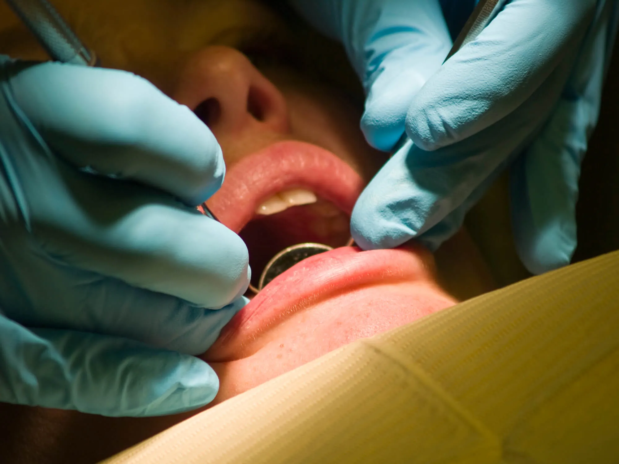 emergency dentist columbia sc