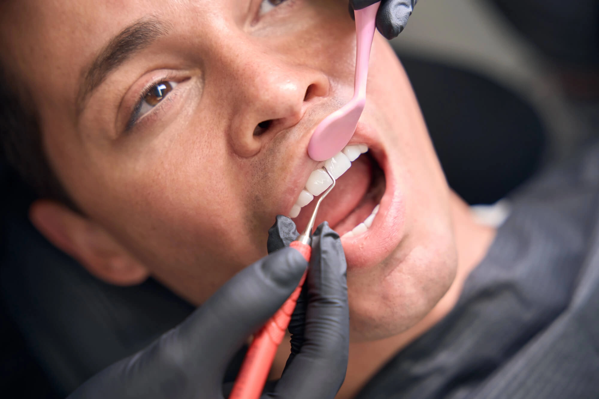 Best Dentist in Columbia SC checking teeth