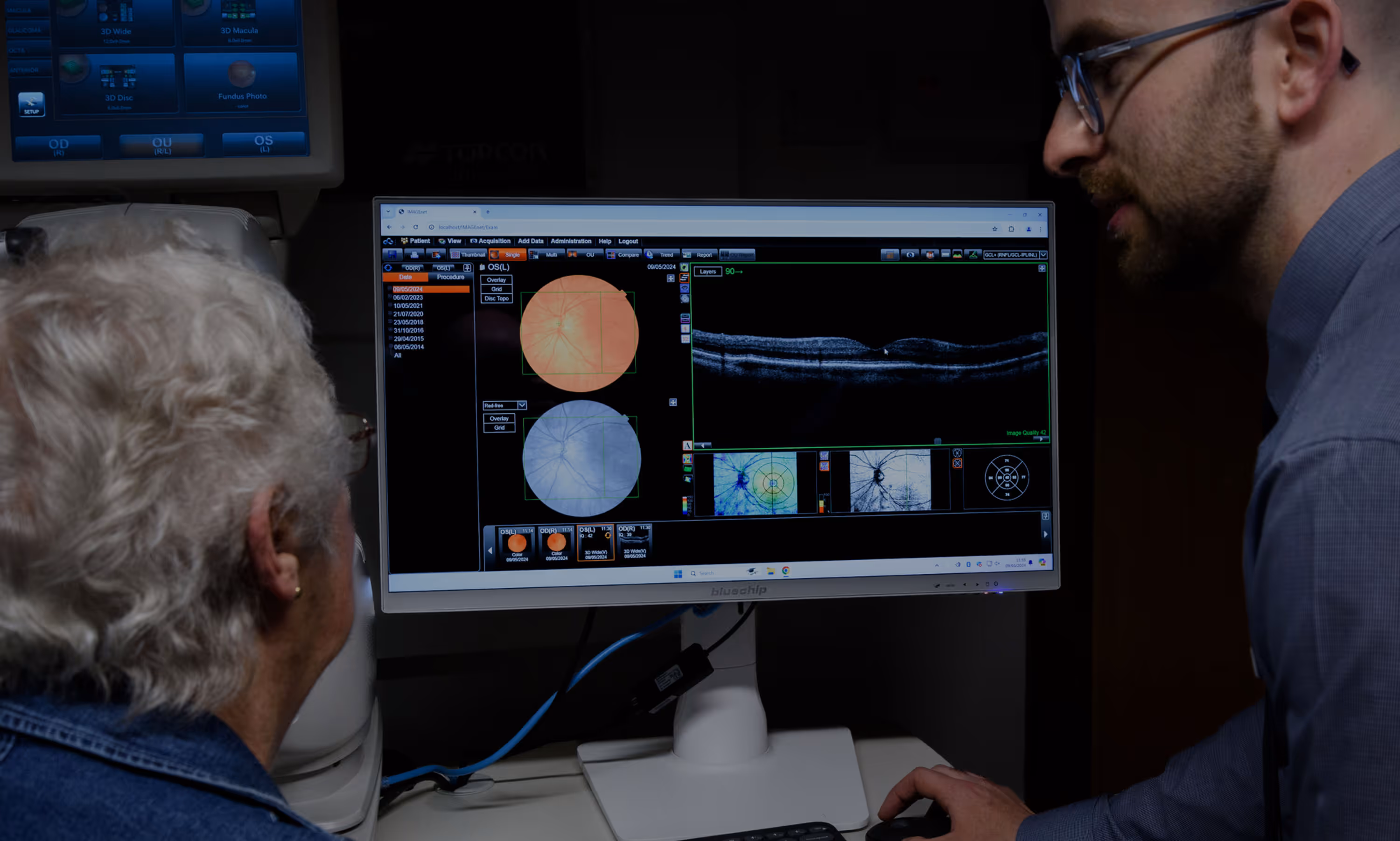 Medical professionals reviewing eye scan images on computer screen