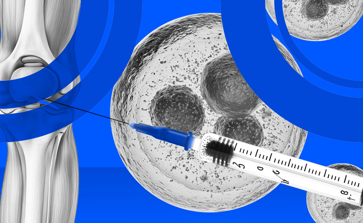 photo illustration of hypodermic needle injecting stem cells into a human knee