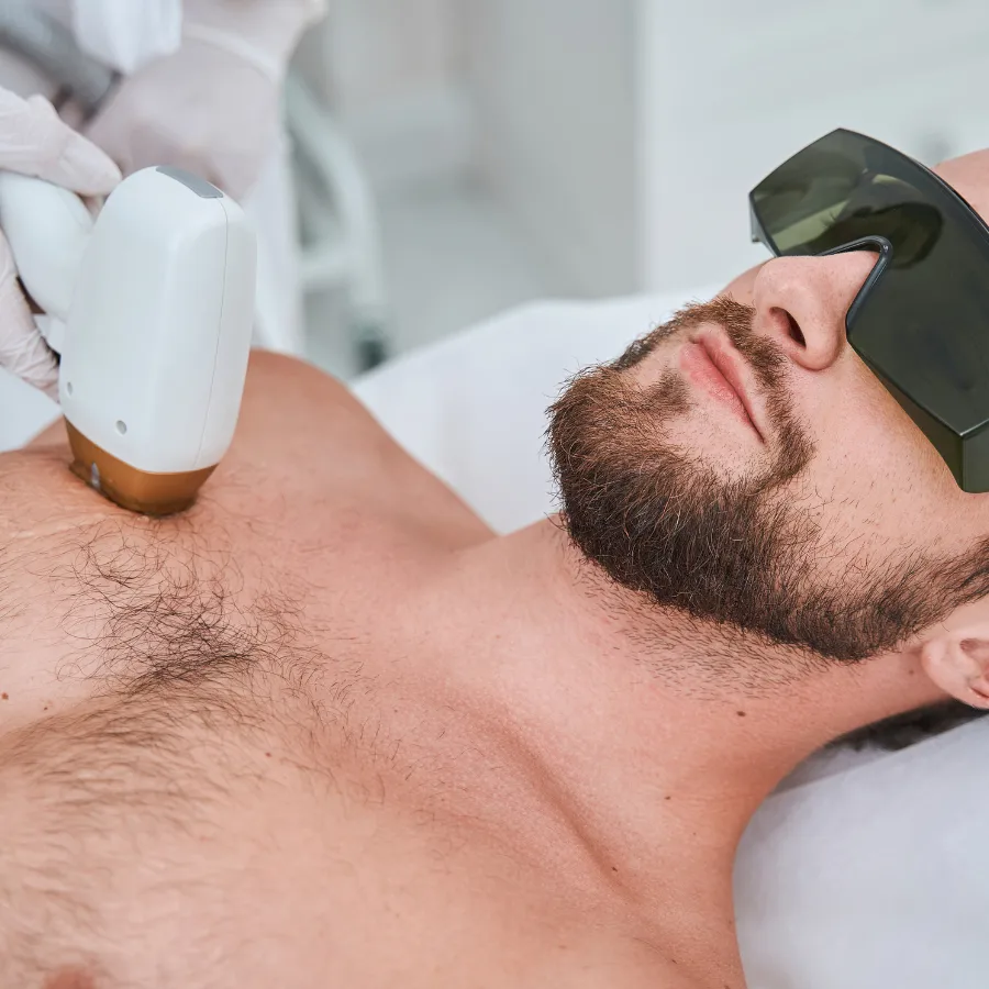 Épilation laser homme