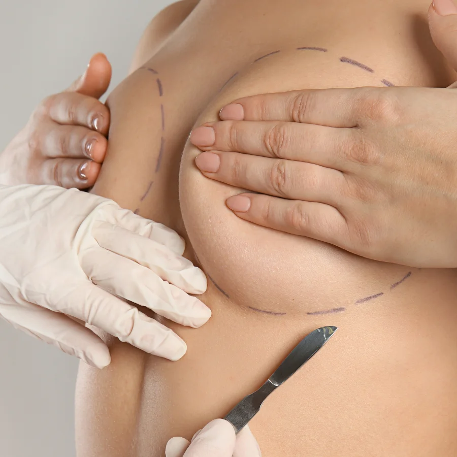Chirurgie mammaire