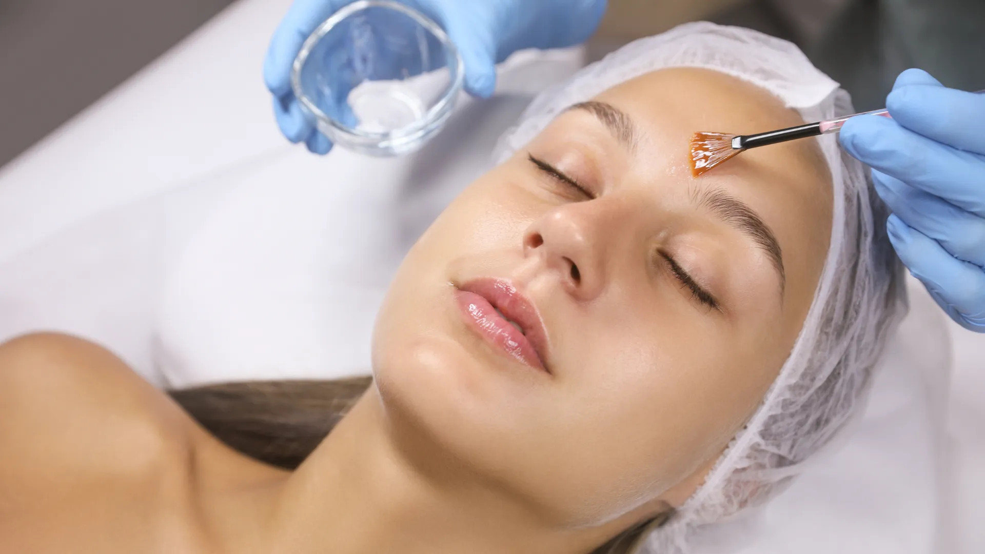 Peeling TCA, glycolique ou Jessner : lequel choisir à Paris 16