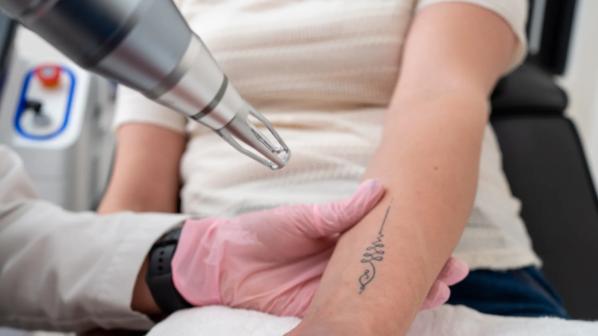 Traitement laser sur un tatouage du bras pour effacement progressif.