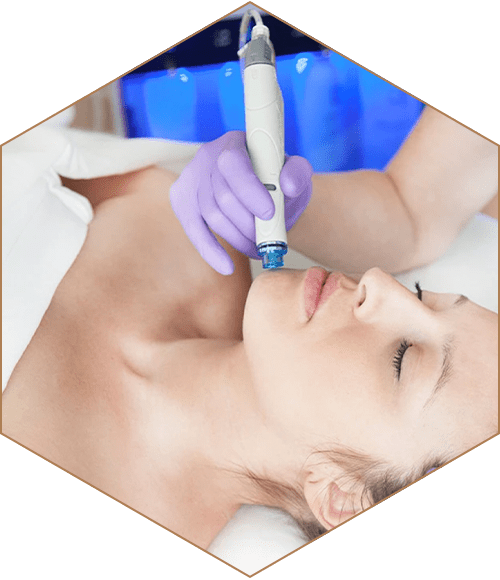 Hydrafacial treatment
