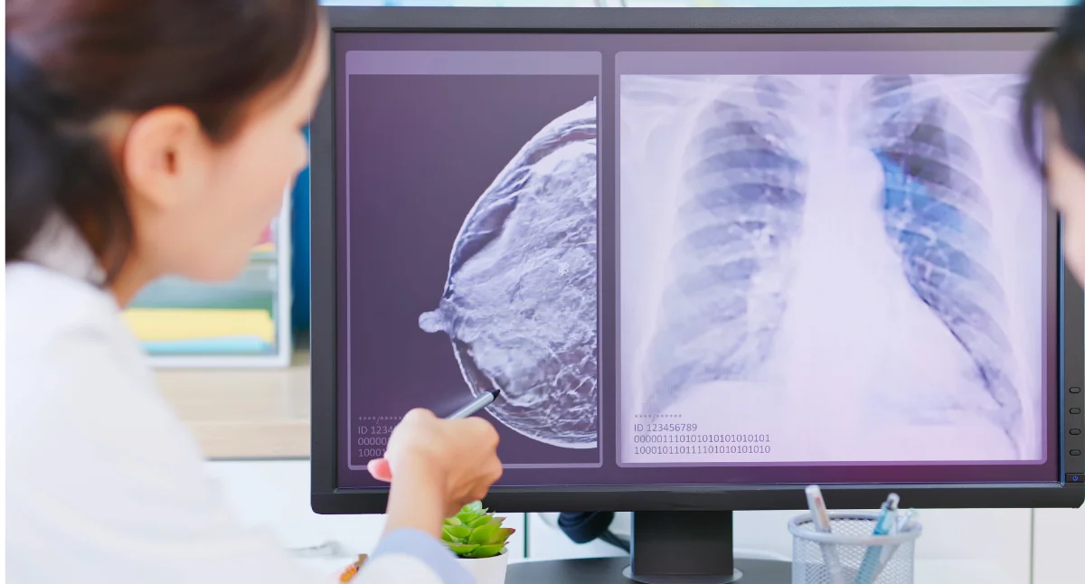 La mammographie, examen de référence du dépistage du cancer du sein.