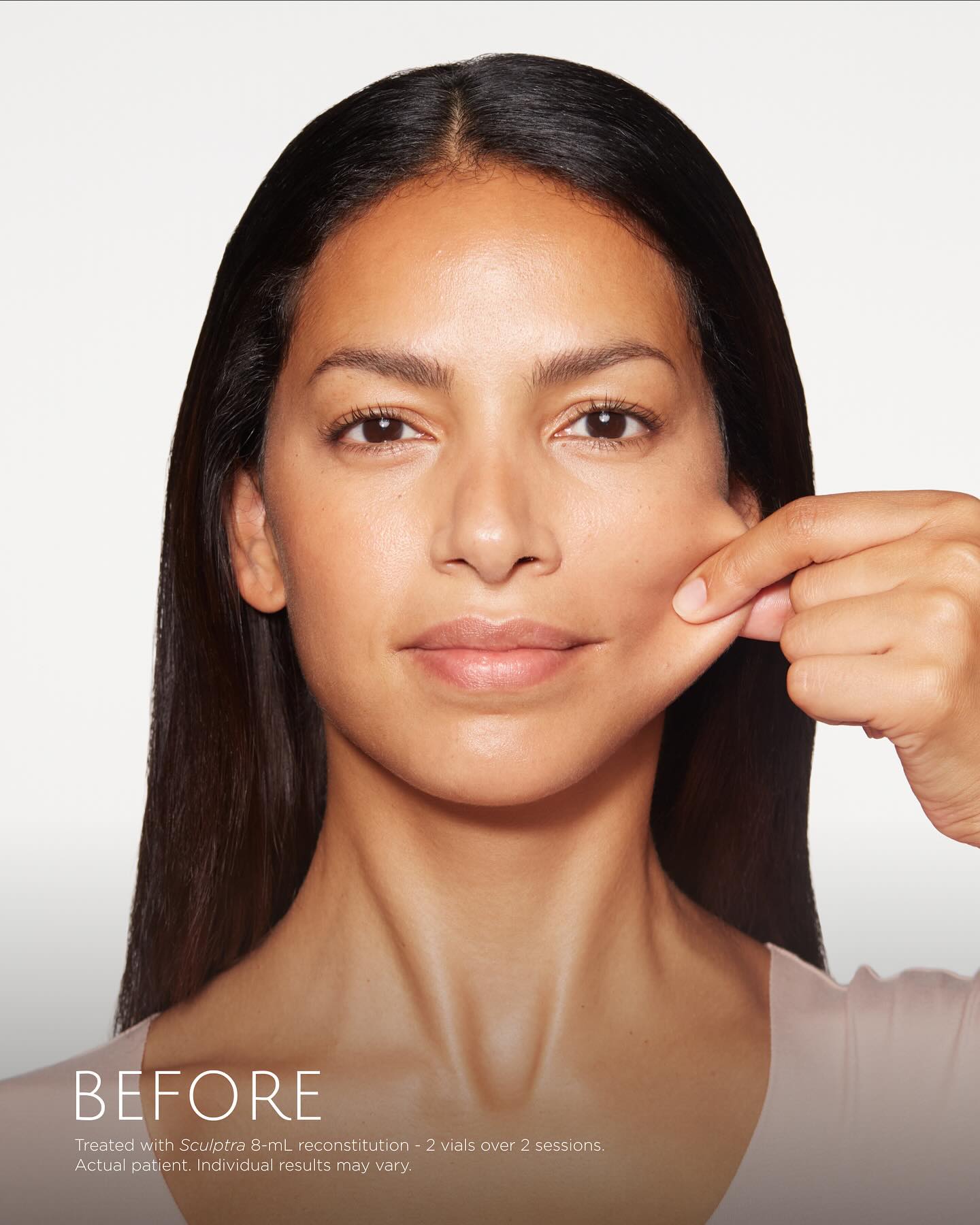 Best Sculptra Spa in Virginia