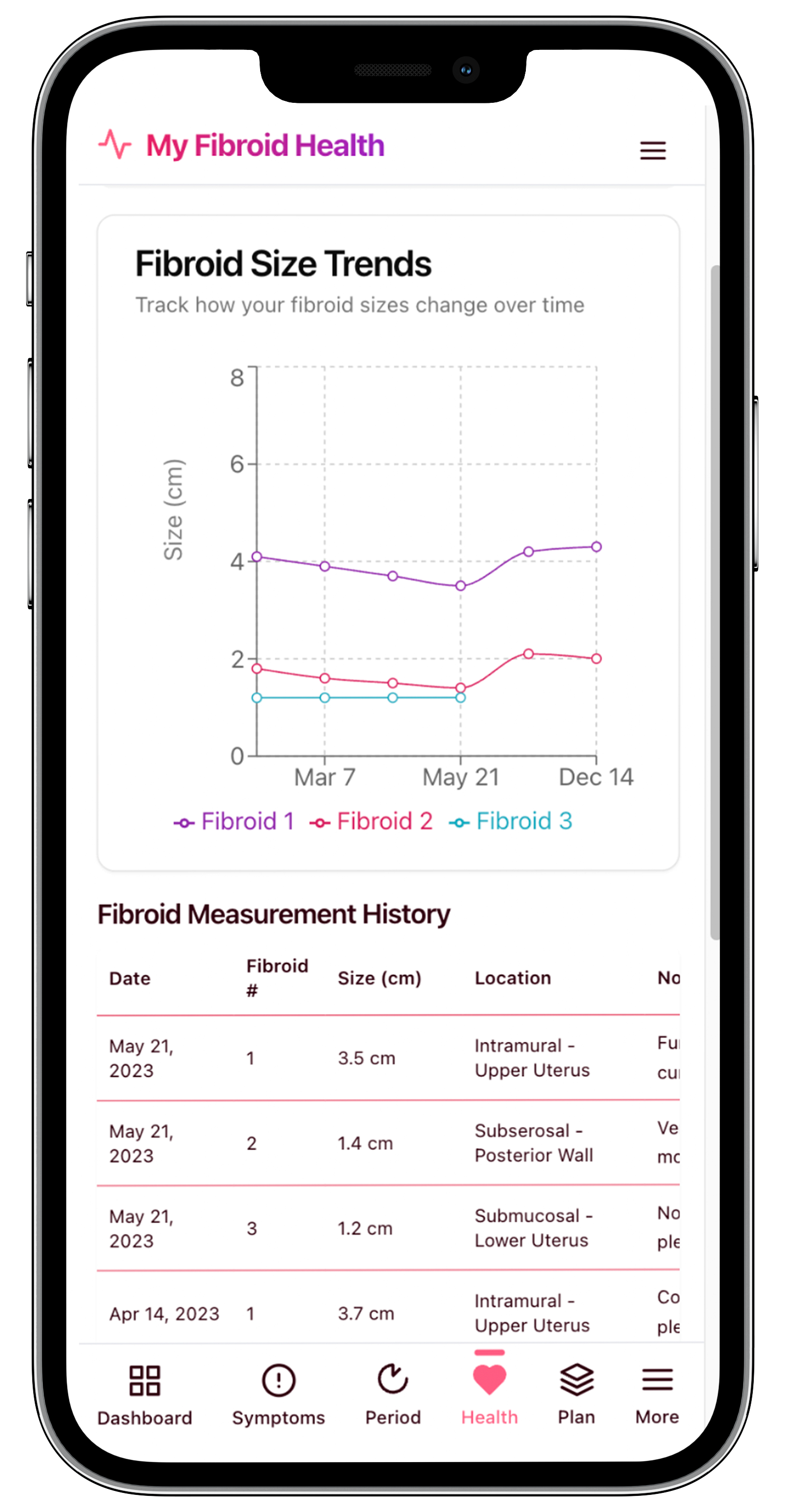 Fibroid Size Trends 