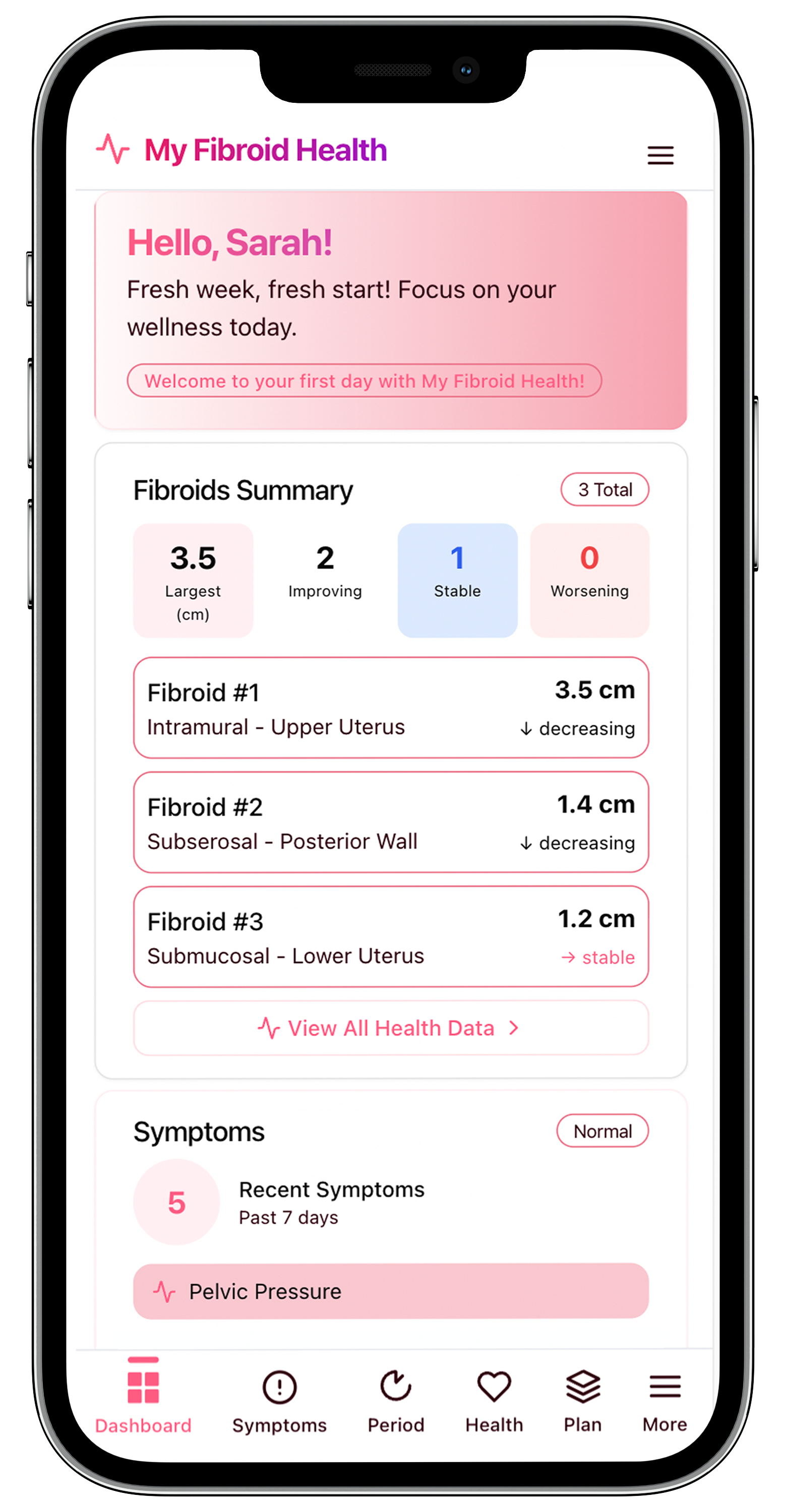Summary infographic explaining fibroid symptoms and treatment options