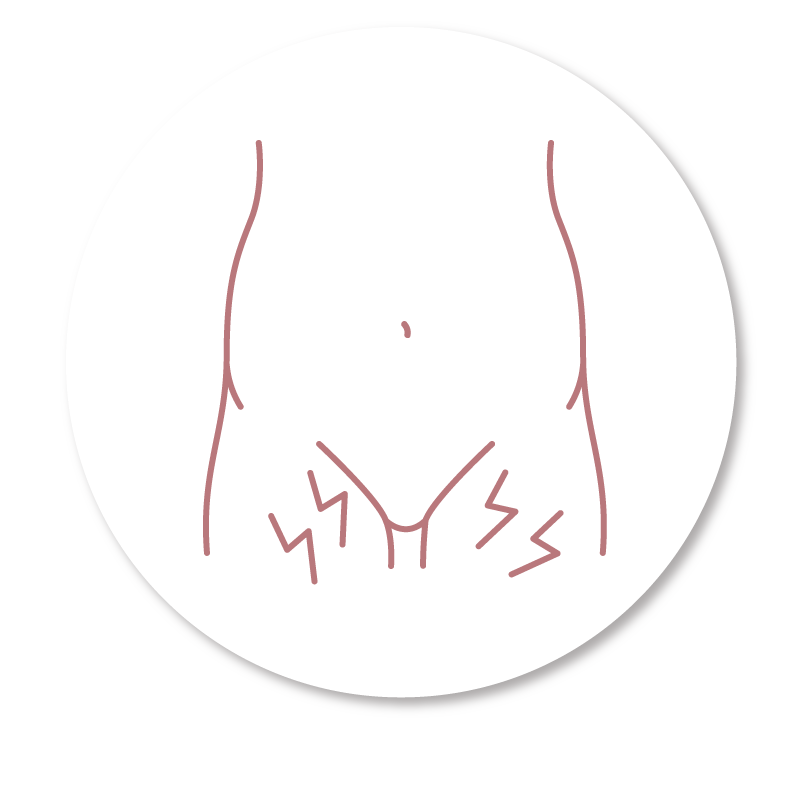 Vulval Conditions