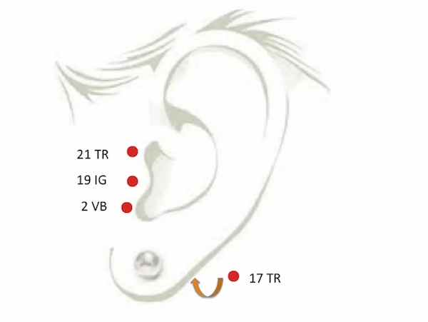 Points d'acupuncture pour l'audition