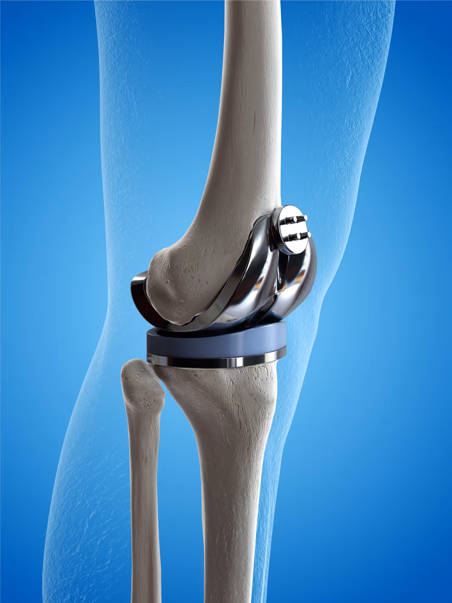 A close up of a human knee with a medical device attached to it.