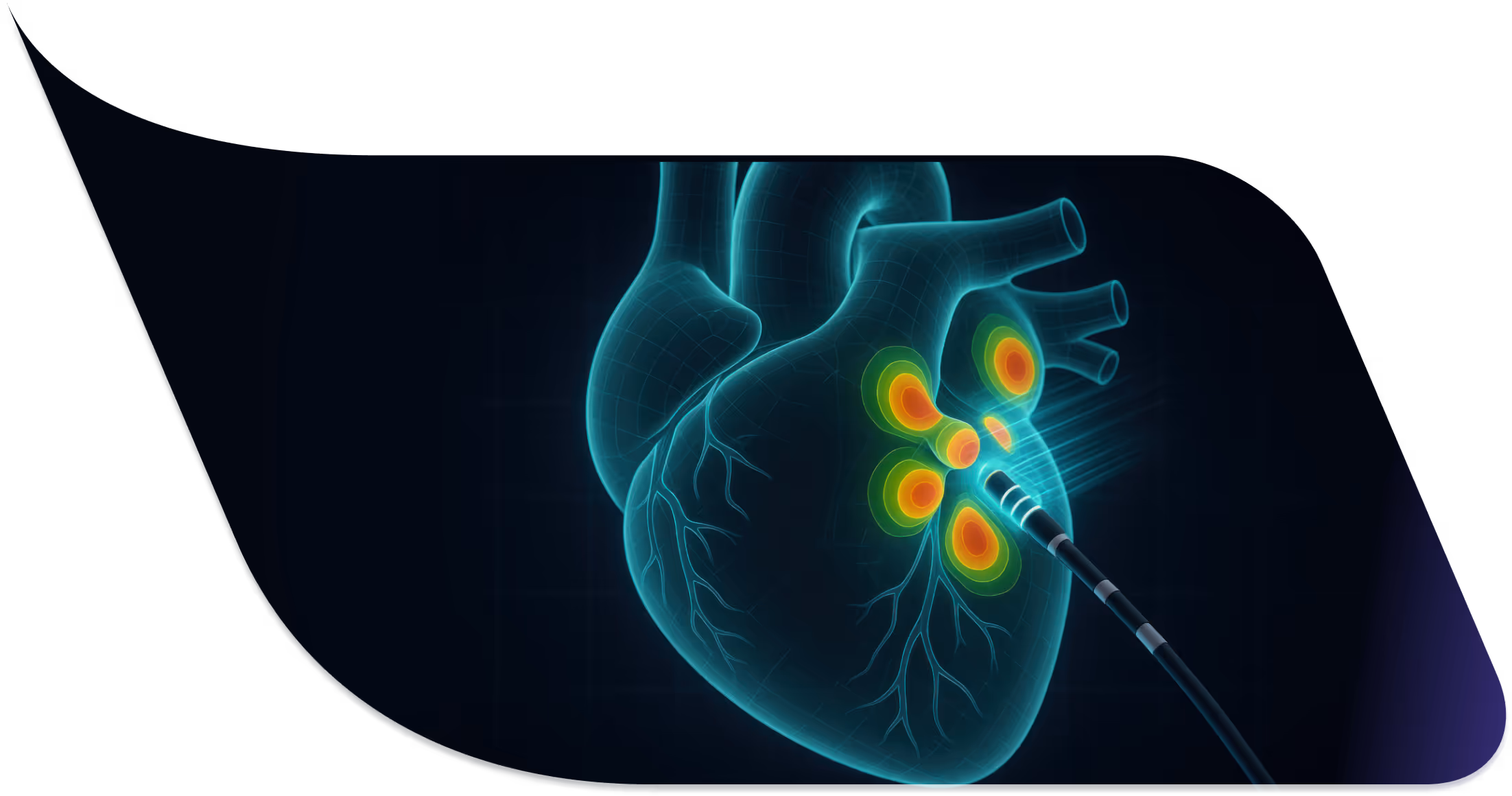 A medical illustration of a heart with a needle hooked to it.