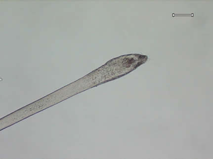 A hair with a telogen root viewed under magnification.