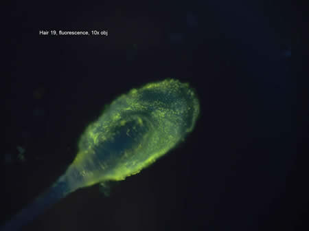 A photomicrograph of a human hair root treated with fluorescent dye, revealing nuclei.