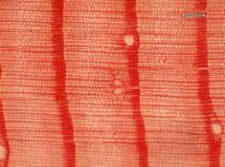 A prepared softwood sample viewed under magnification.