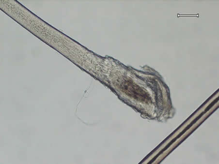 A hair with a catagen root viewed under magnification.