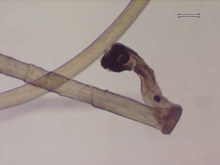 A hair with an anagen root viewed under magnification.