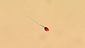 Sperm cells viewed under a microscope, with heads stained red and tails stained green.