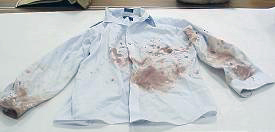 A shirt with red-brown staining submitted as evidence.