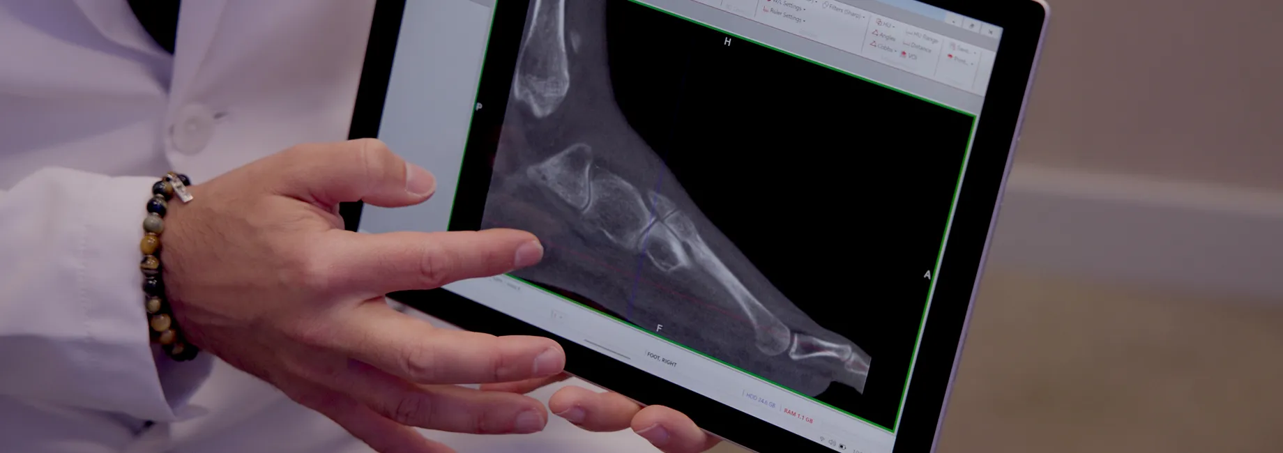 Dr. Soomekh pointing to an x-ray of a foot