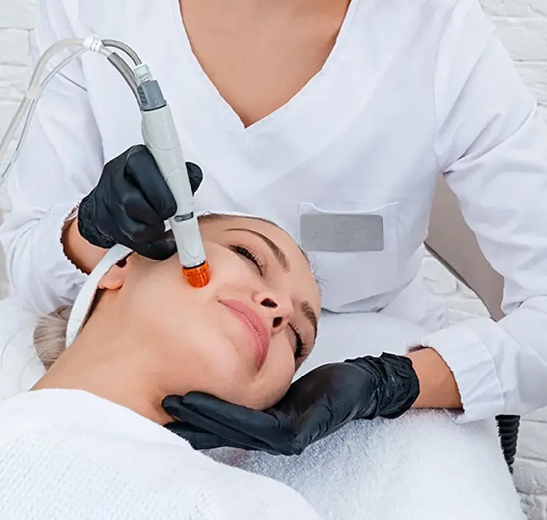 woman getting microdermabrasion treatment on face