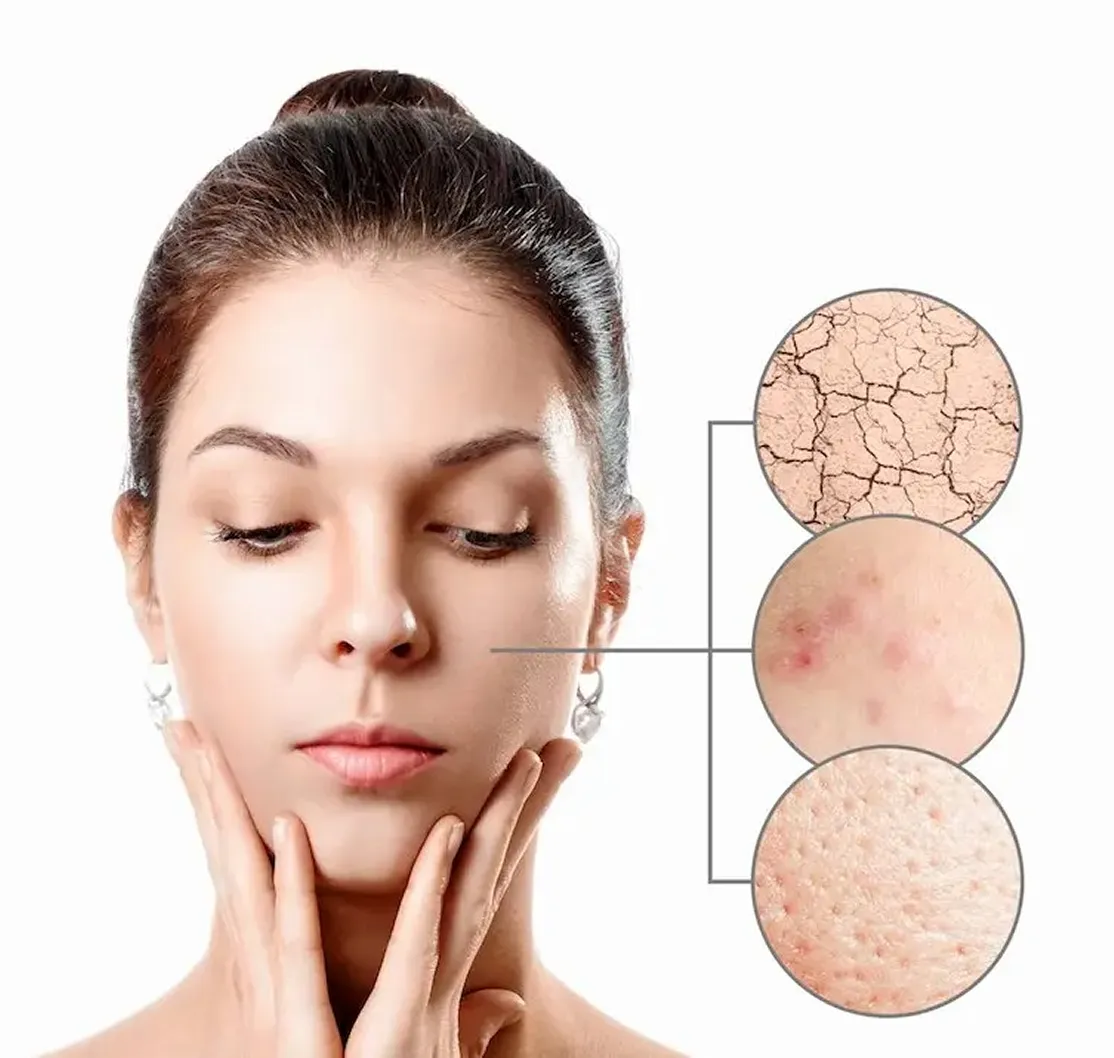 common-skin-concerns-300x2387