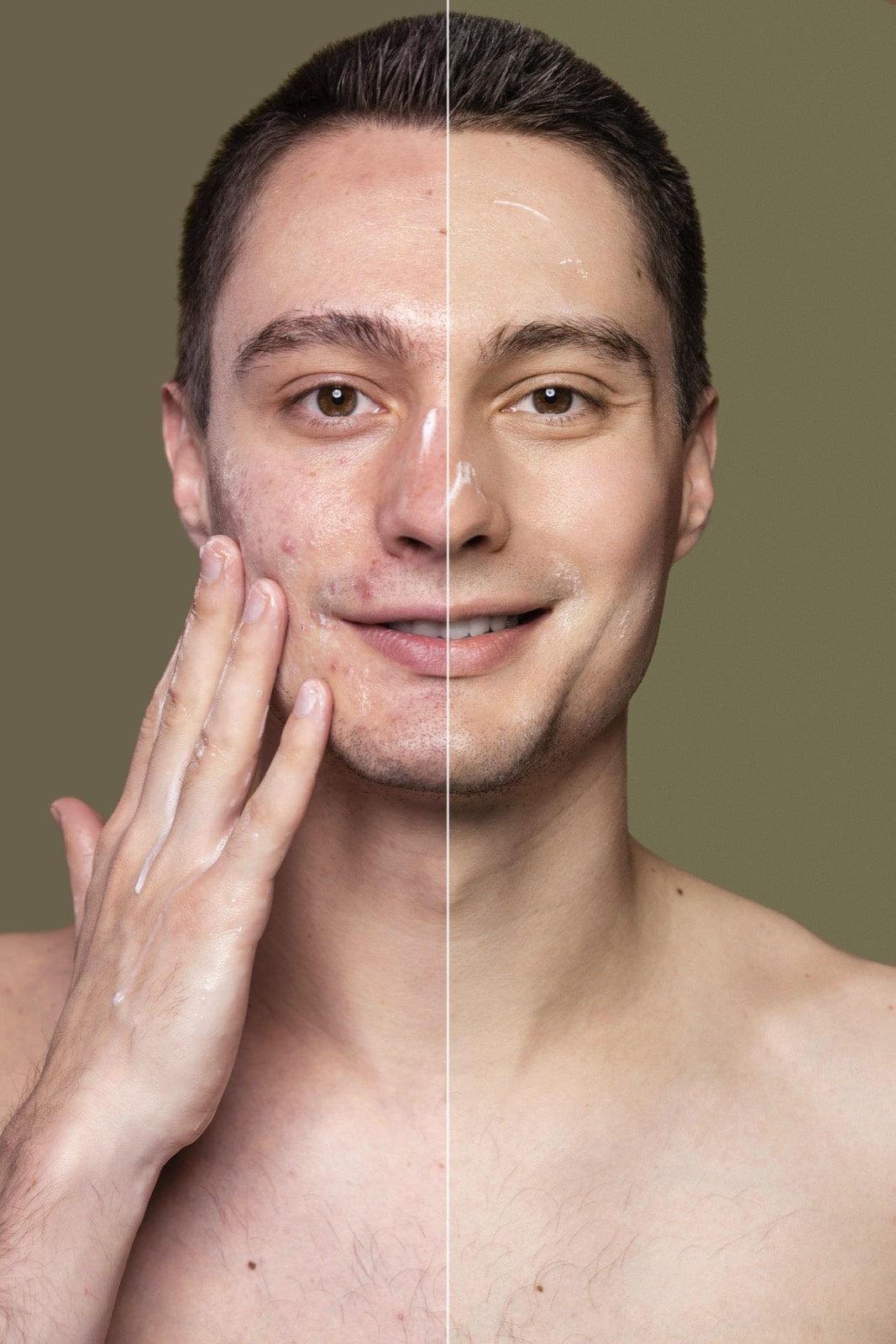 Ergebnisse des medizinischen Peelings