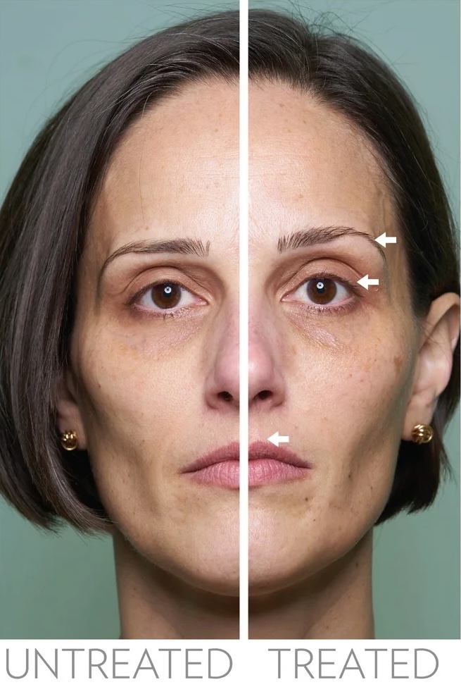 Résultats Nu Skin