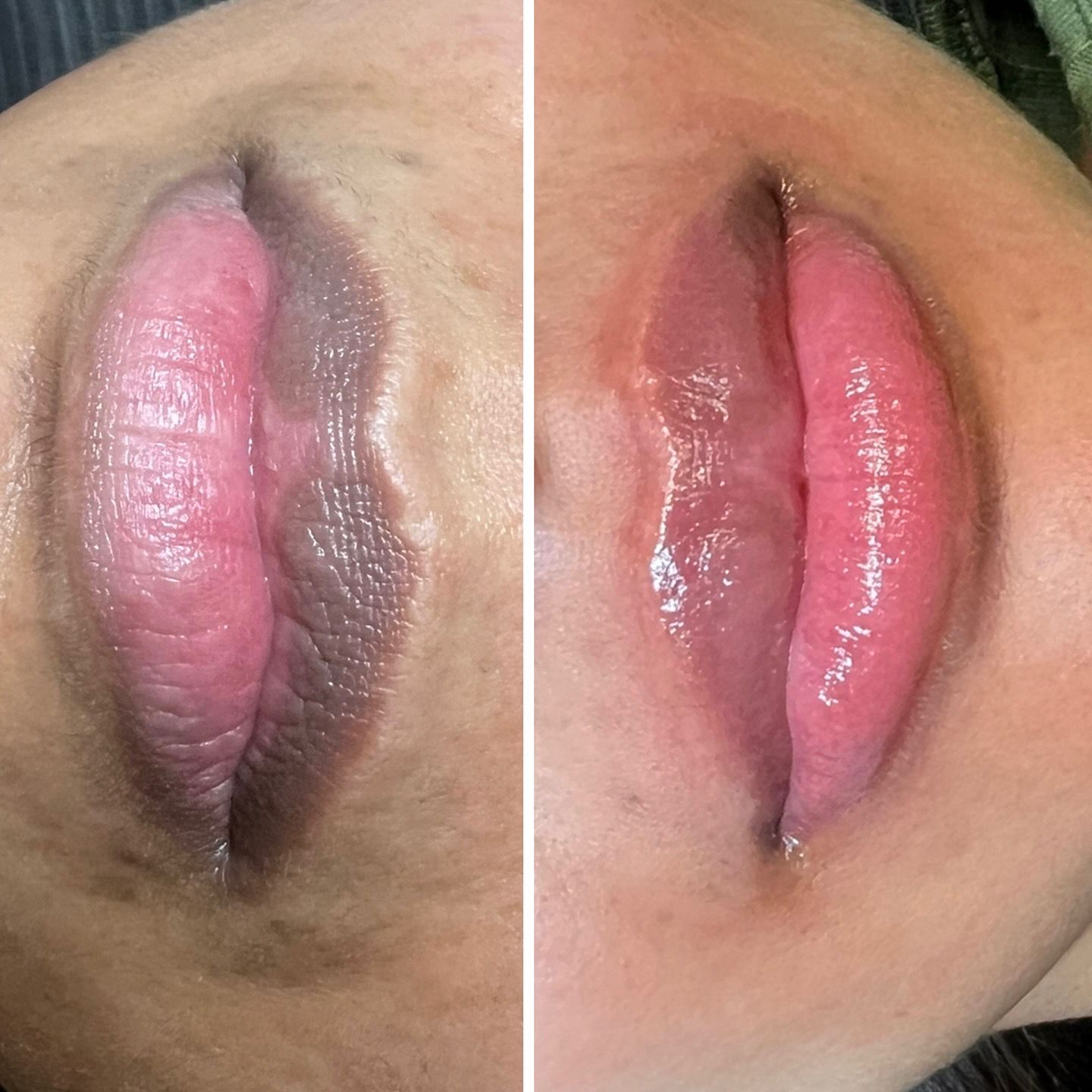 Résultats Microblading & Candy Lips