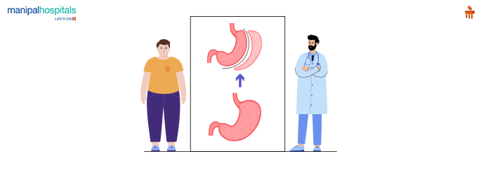 How Does Bariatric Surgery Help in the Reversal of Diabetes?