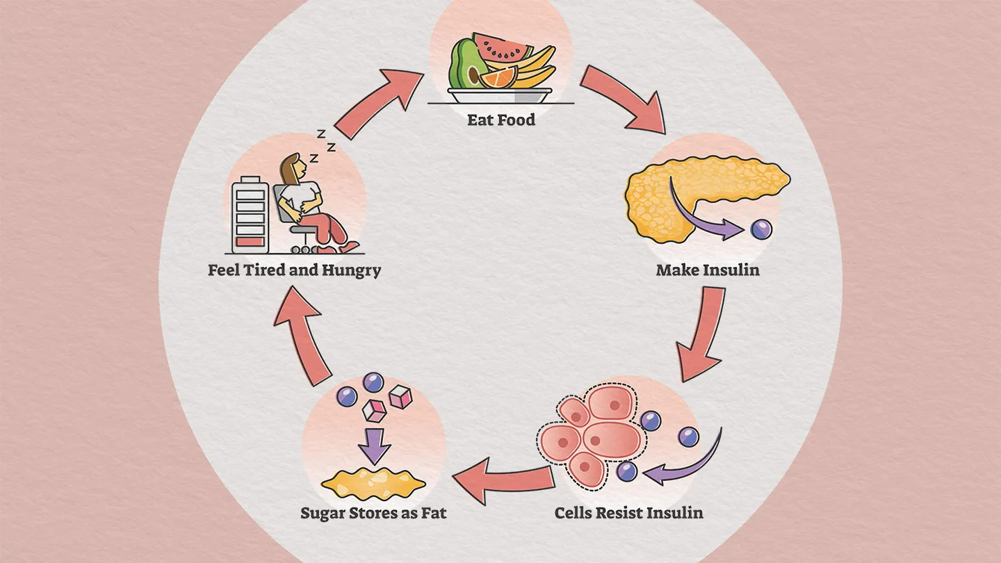 What Role Does Insulin Resistance Play in Type 2 Diabetes Progression?
