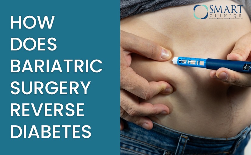 How effective is bariatric surgery in managing or reversing diabetes?